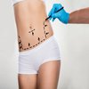 Avatar of Liposuction in Riyadh