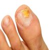 Avatar of treattoenail