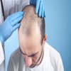 Avatar of Hair Transplant in Riyadh