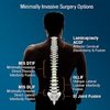 Avatar of Cervical Myelopathy