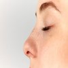 Avatar of Cost of Rhinoplasty in Saudi Arabia