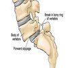 Avatar of SpineSurgeon