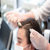Avatar of PRP hair treatment in Riyadh