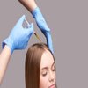 Avatar of PRP Hair Treatment in Riyadh