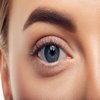 Avatar of Eyelid Surgery in Riyadh
