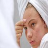 Avatar of Acne Scar Treatment in Riyadh