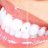 Avatar of Teeth Whitening Mandurah