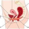 Avatar of Fibroids Treatment And Removal