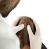 Avatar of Exosomes Therapy for Hair Loss in Riyadh