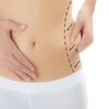 Avatar of Best Liposuction in Riyadh