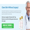 Avatar of Amarose Skin Tag Remover