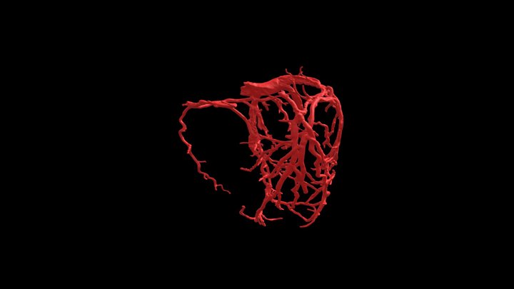 Combined Coronary Vasculature Model- Heart0256 3D Model