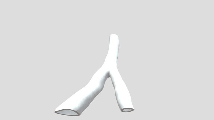 Bespoke Nerve Conduit 3D Model