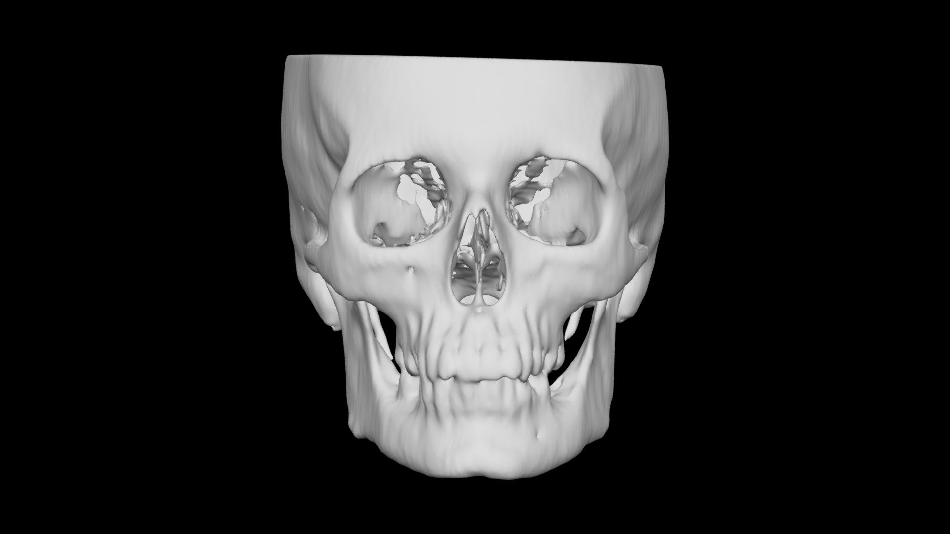 Skull Female 59yo