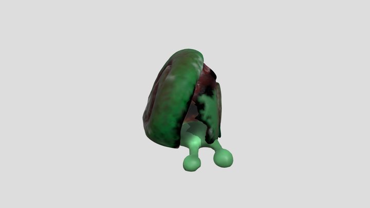 Concha de caracol Fracturada