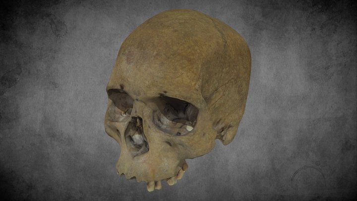 human scull