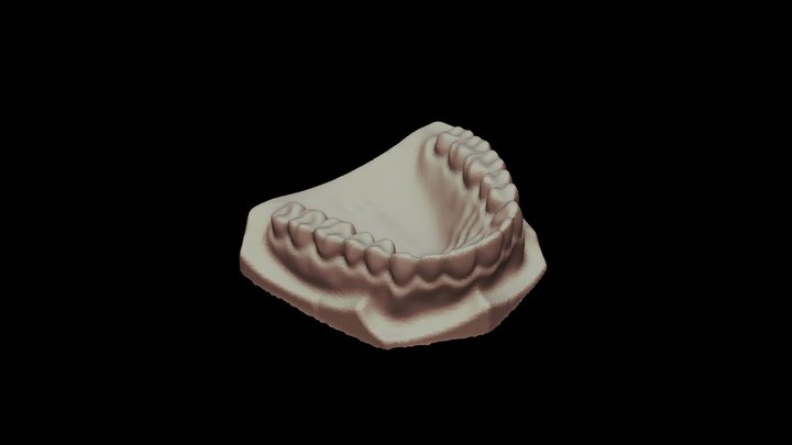 dental cast 3D Model