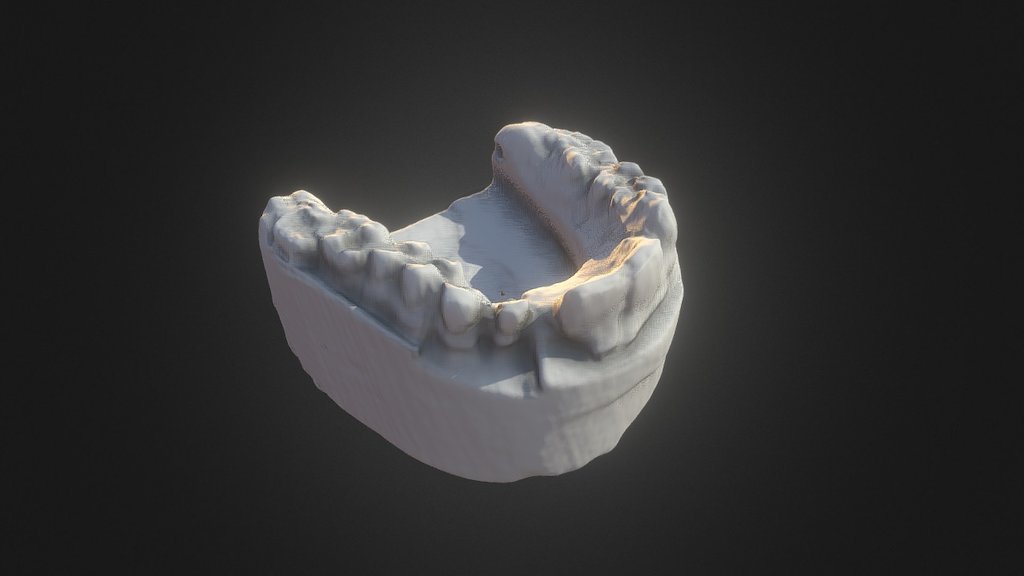 Dental imprints
