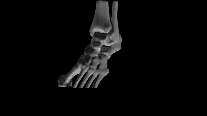 Left Ankle Reconstruction 3D Model