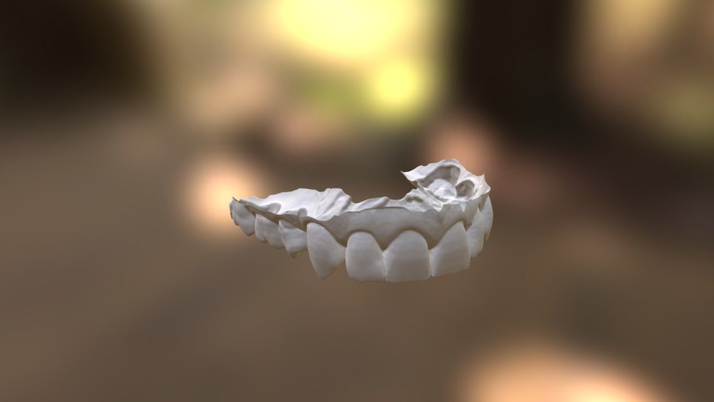 Helen Upper Jaw
