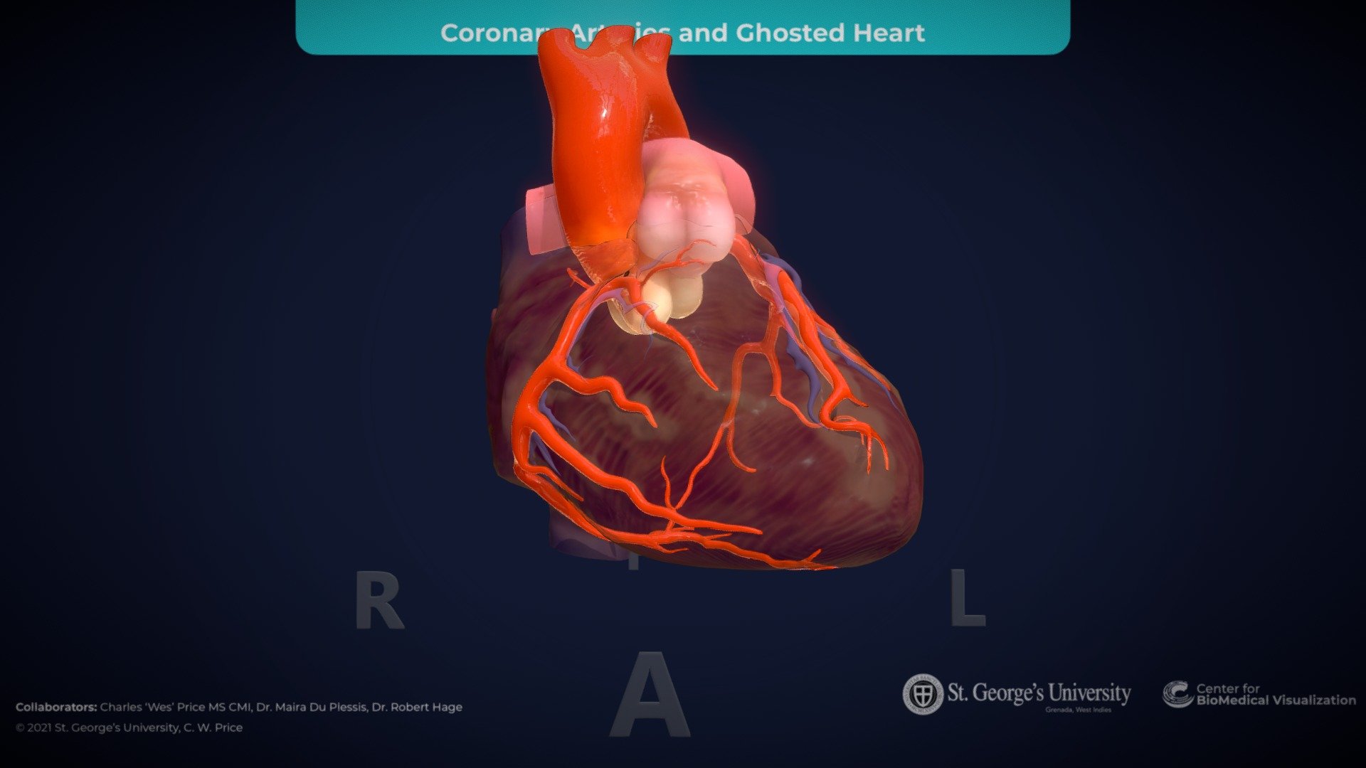 Coronary Arteries - Ghosted Heart - 3D model by The Center for ...