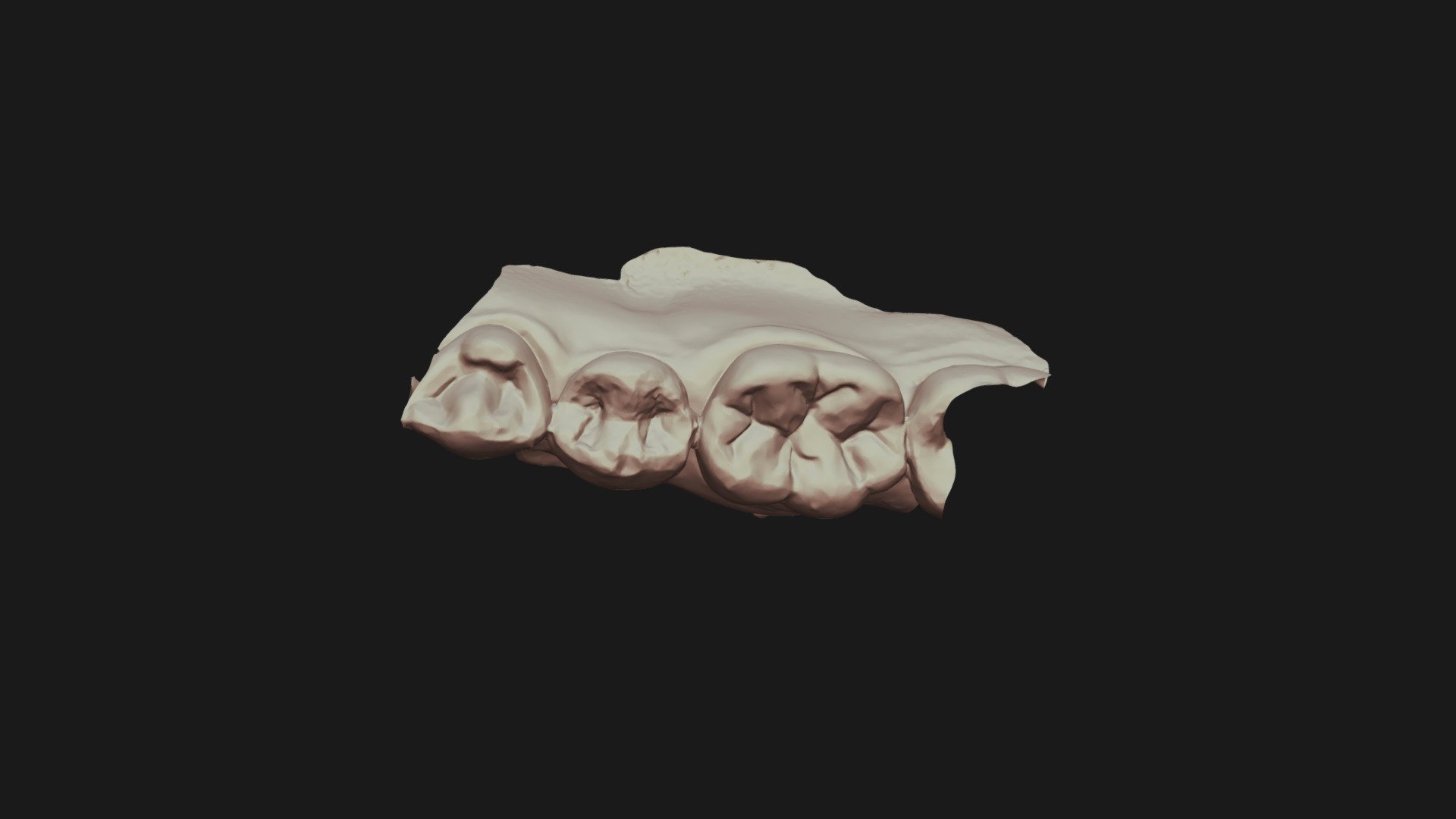 Group 6 Wax 20 B Lower Jaw