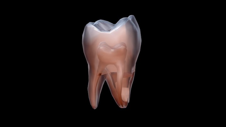 diente25 3D Model