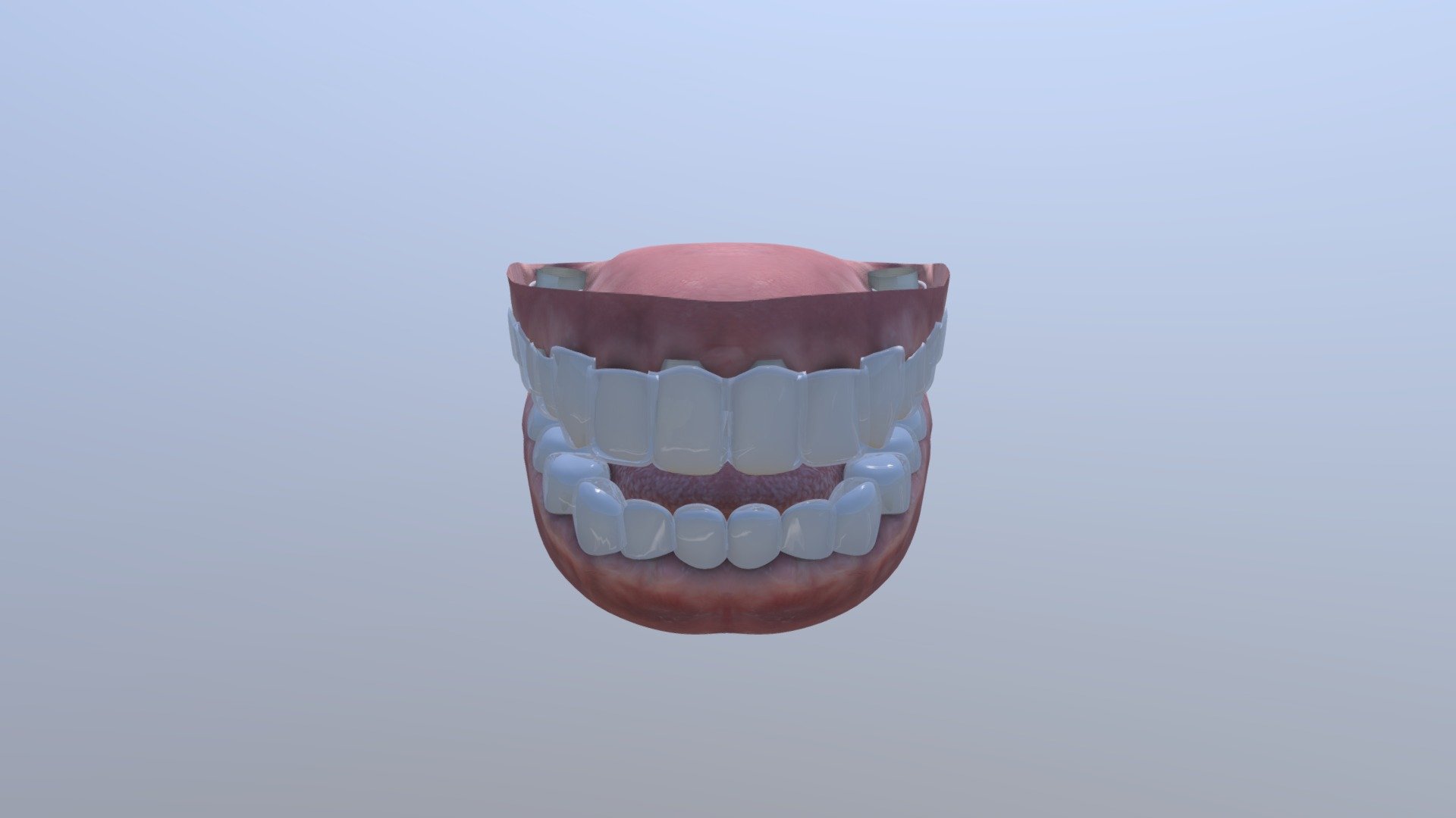 Dentes