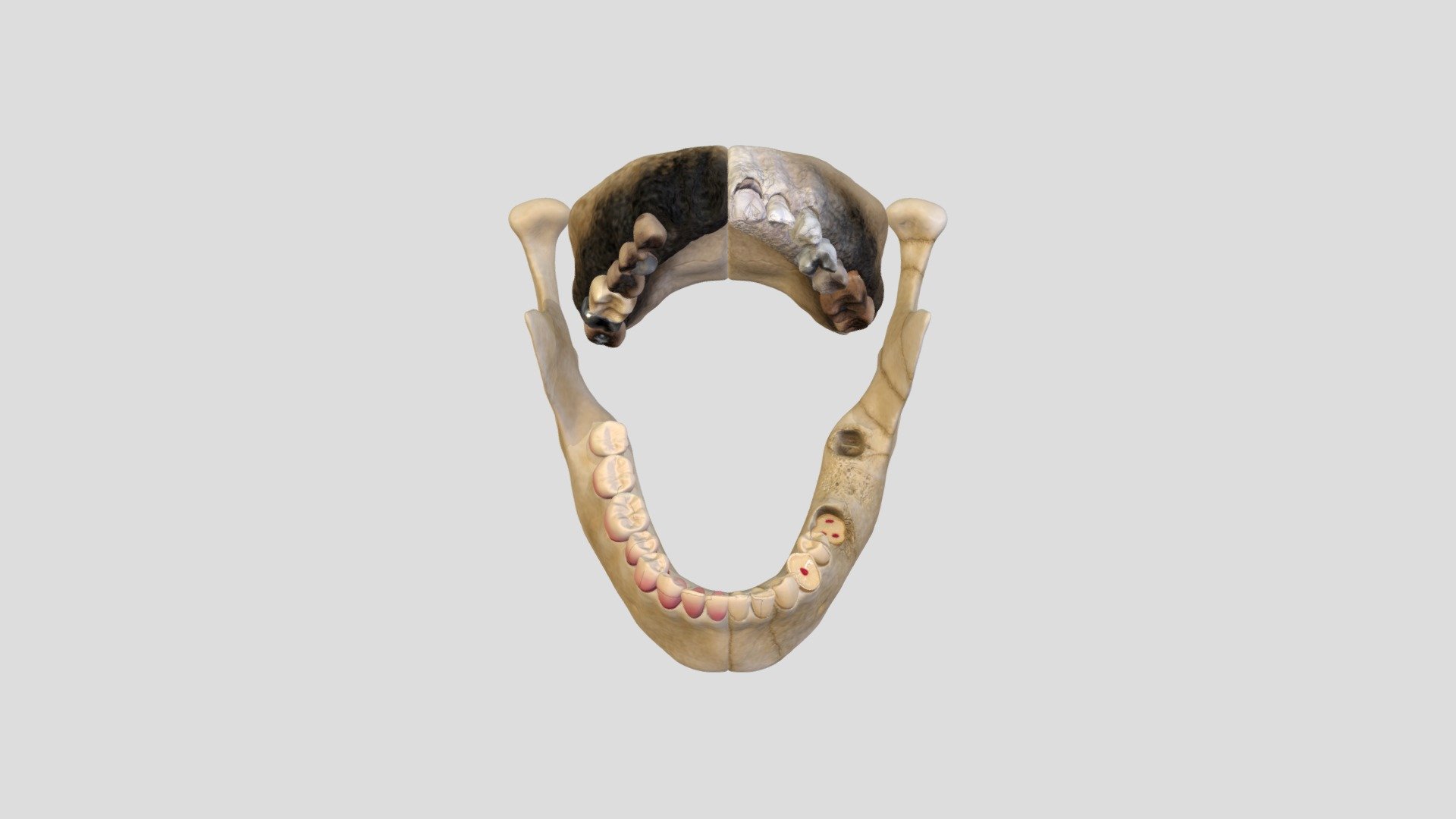 Dental Damage