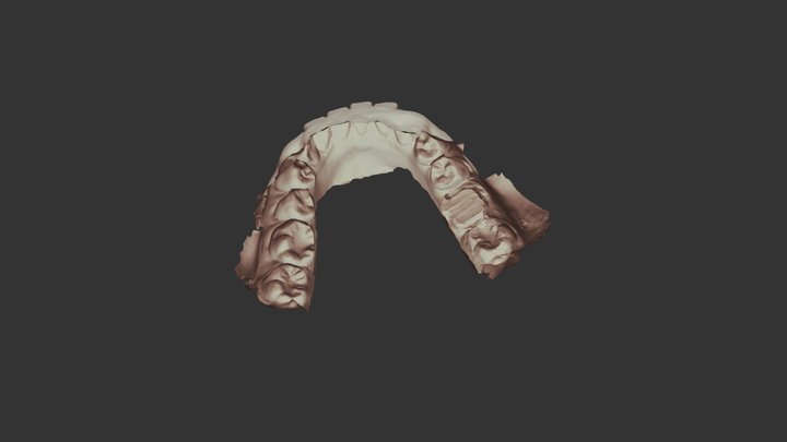 36 BPR Lower Jaw Scan 3D Model
