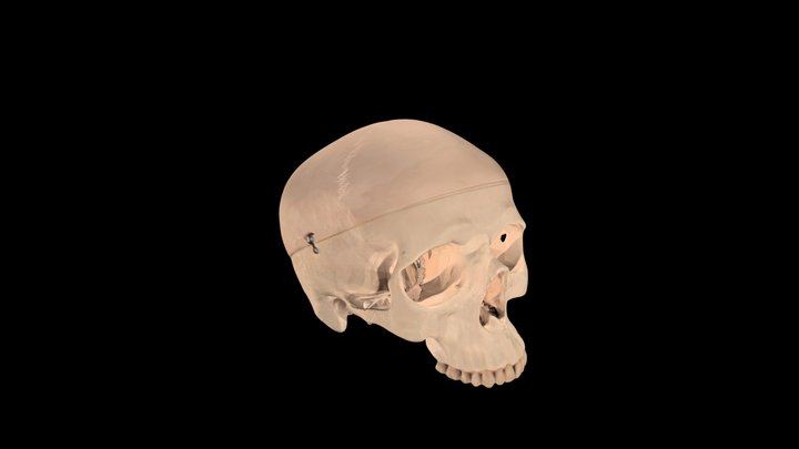 Example Cranium 3D Model