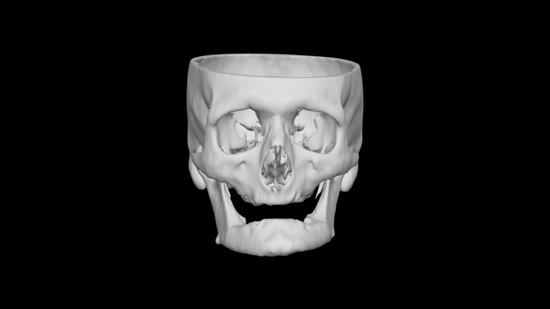 Skull Male 53yo