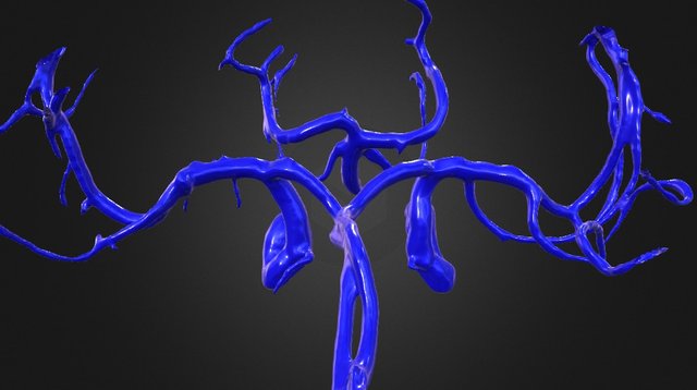 Normal cerebral arteries N001 3D Model