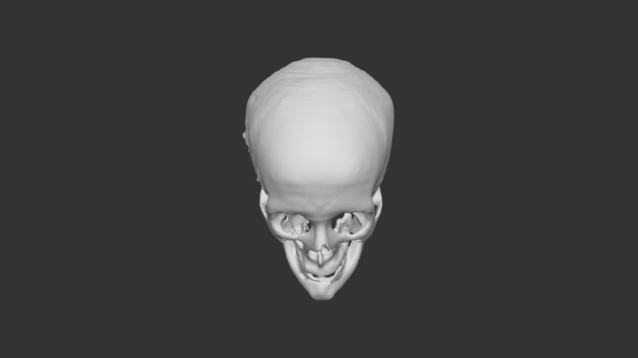 CT Sckull 3D Model