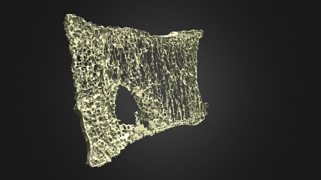 Vertebrae Sections - A 3D model collection by Alexander Jon Cresswell ...