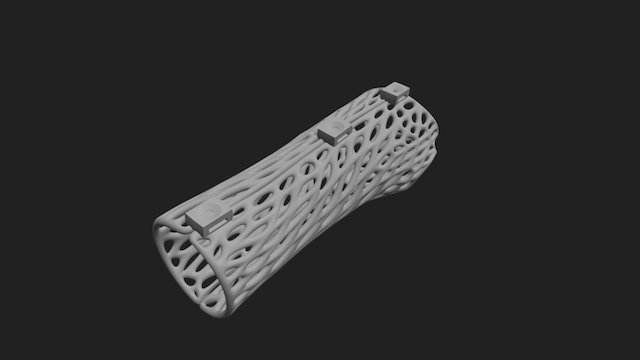 Attelle [Patient 1] (V1 pour Gaël ABS) 3D Model