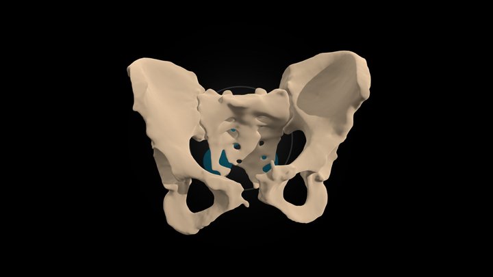 HumanX Medical Case Study #002 3D Model