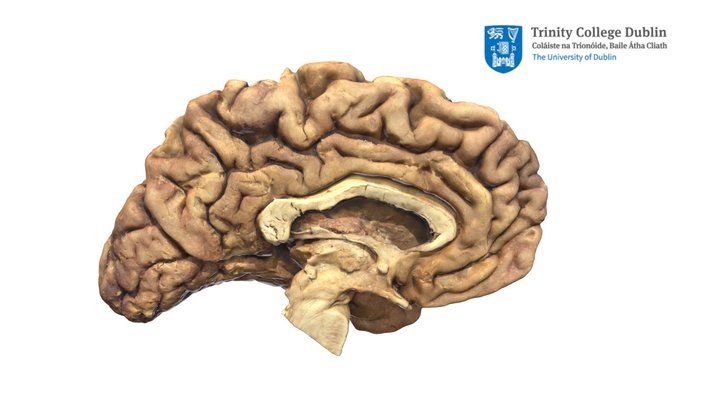 Medial Surface: Sulci and Gyri 3D Model