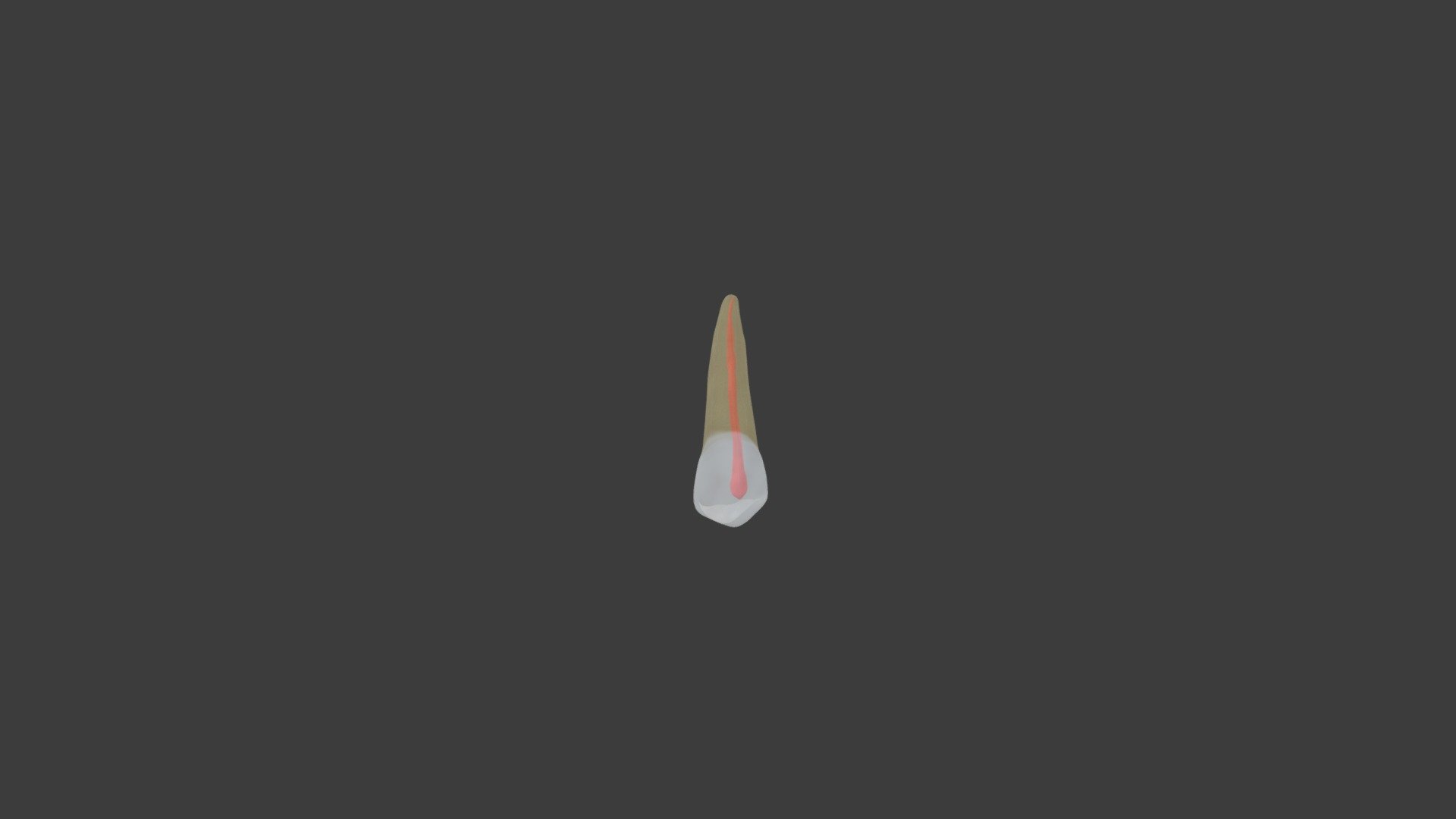 Maxillary 2nd Premolar Type 7