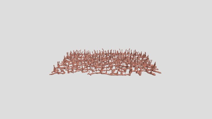 Large-lymph_oculus3 3D Model