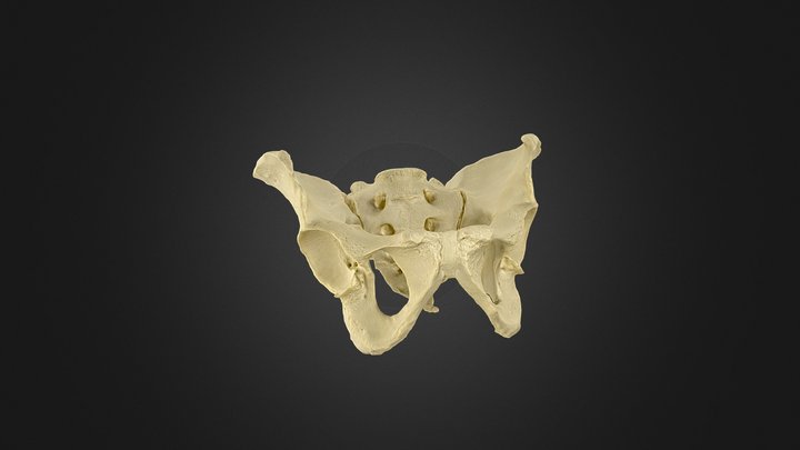 Pelvis COMP-113-1 3D Model