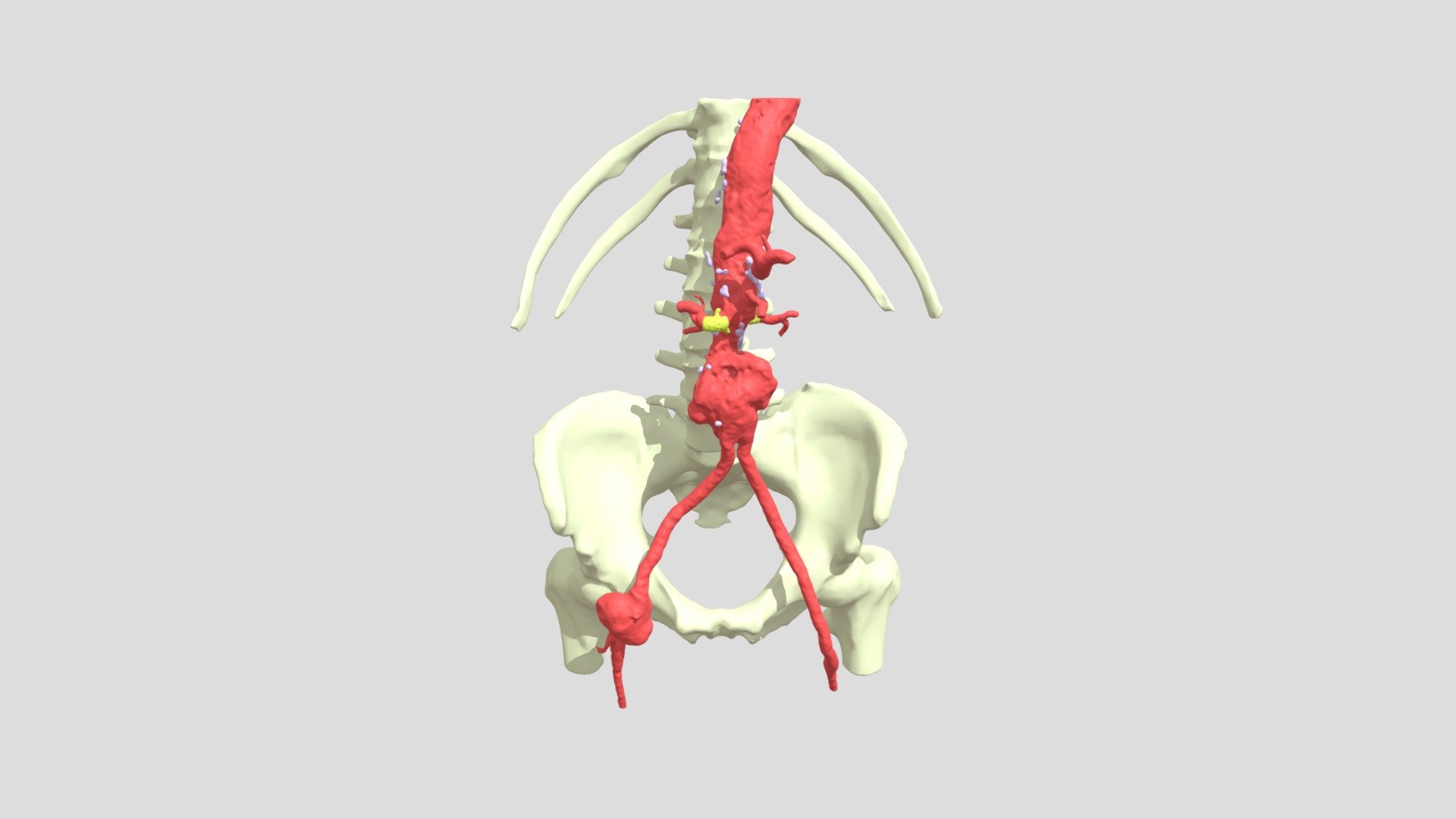 PR230017_ Aorta - 3D model by validainnovation [0339b13] - Sketchfab