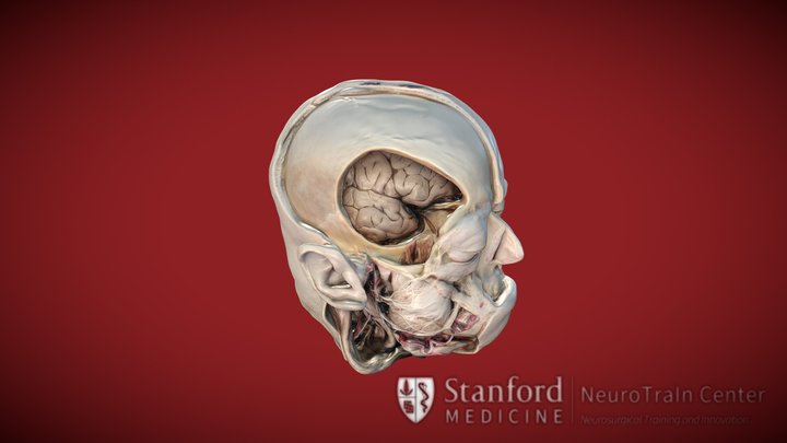Deep Facial Nerve Anatomy 3D Model