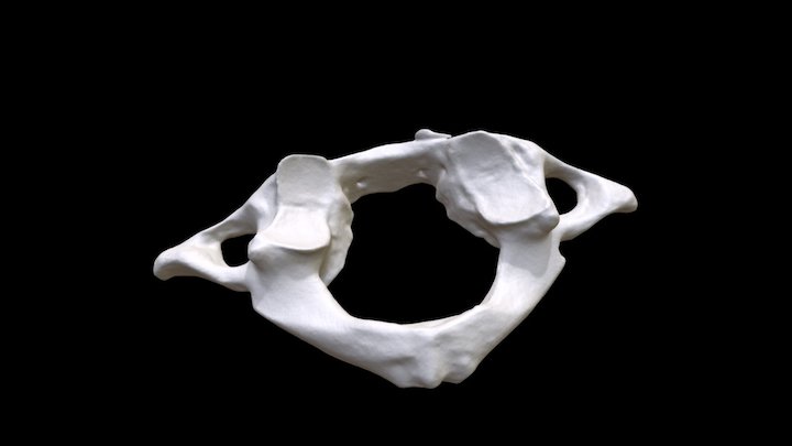 Human Atlas C1 vertebra 3D Model