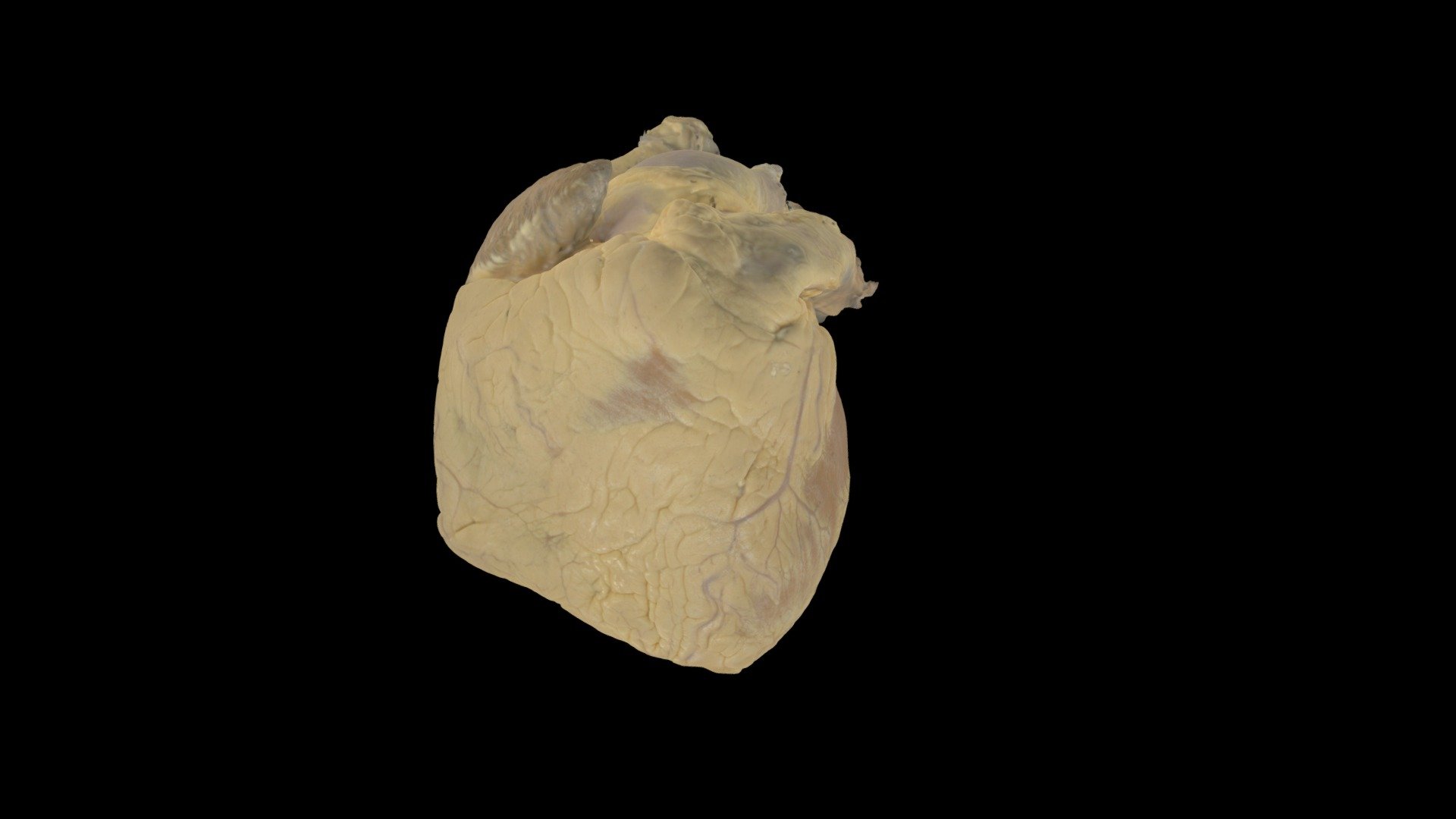 Perfusion Fixed Human Heart #0223