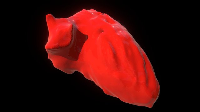 Patient-specific left ventricle blood pool 3D Model
