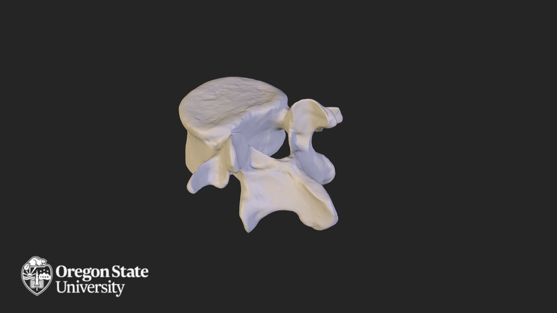 Lumbar vertebra - L5