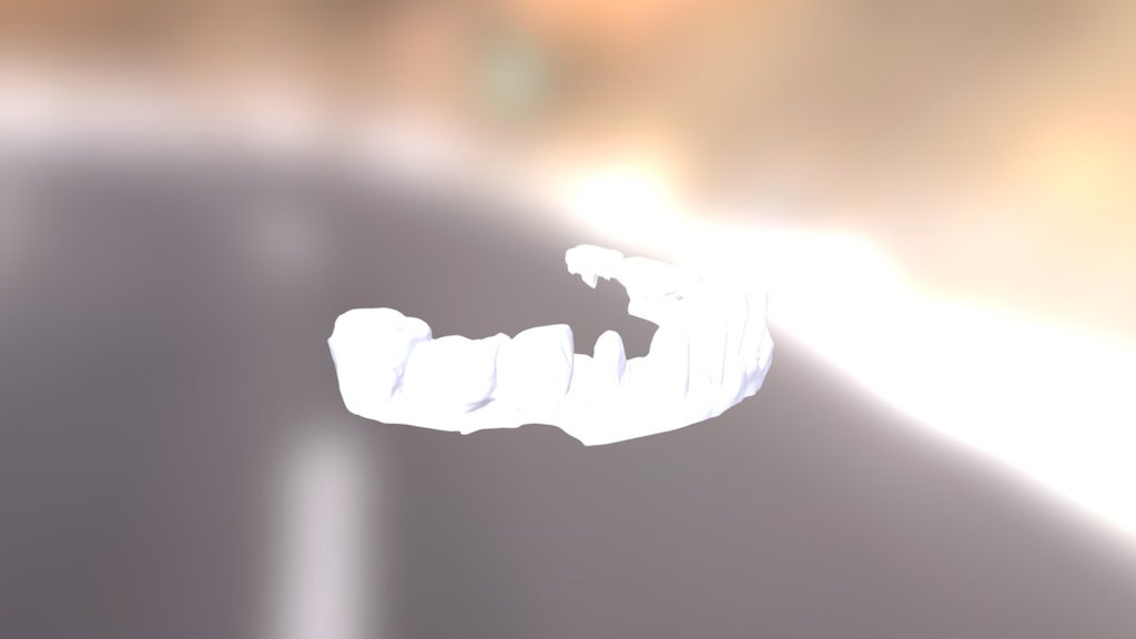 Felicity Lower Jaw