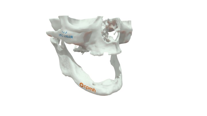 Pedido 5856 - Implantize 3D Model