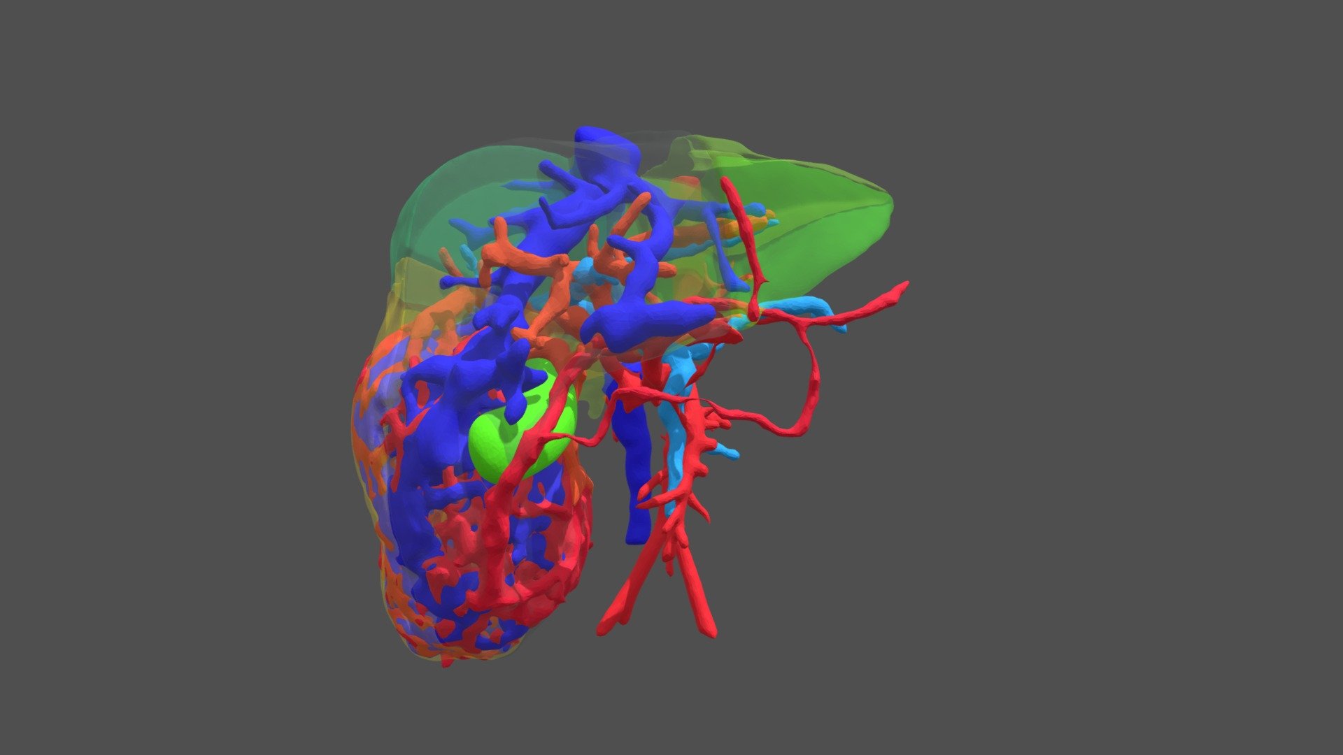 Hepatic hemangioma 3D model by thorac.topsurgery [03de232] Sketchfab